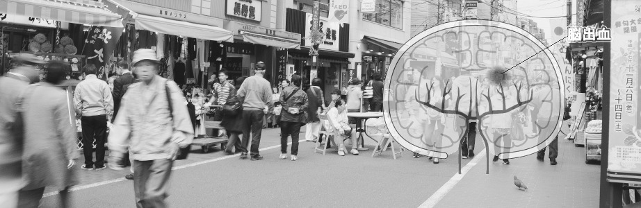 突然、脳出血に見舞われたらあなたならどうしますか？【脳出血リハビリ記録】